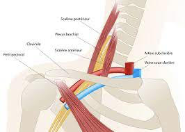 Défilé thoraco-brachial — vue 3